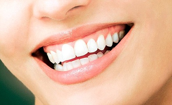 teeth whitening kit
